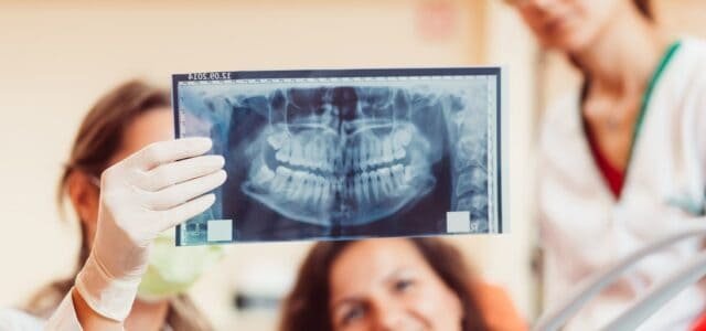 Radiografías panorámicas e intraorales